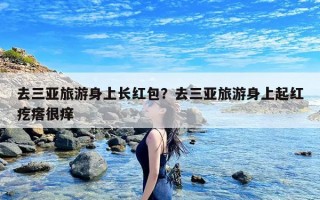 去三亚旅游身上长红包？去三亚旅游身上起红疙瘩很痒