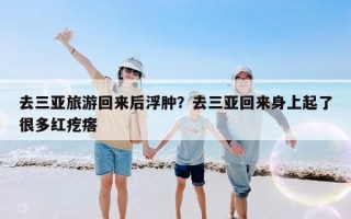 去三亚旅游回来后浮肿？去三亚回来身上起了很多红疙瘩