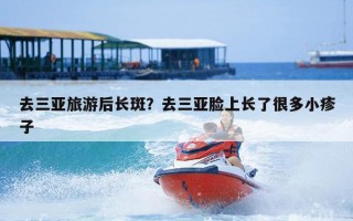 去三亚旅游后长斑？去三亚脸上长了很多小疹子