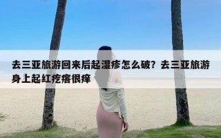 去三亚旅游回来后起湿疹怎么破？去三亚旅游身上起红疙瘩很痒